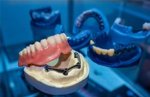 Example of implant dentures from Peery & Woolwine Family Dentistry
