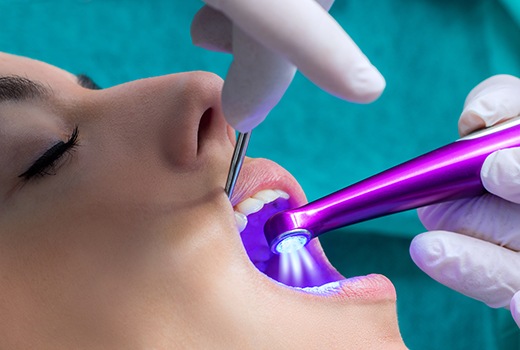 Girl getting a dental sealant