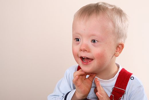 little boy with special needs smiling and opening his mouth