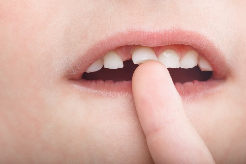 A finger pointing to a child’s loose tooth